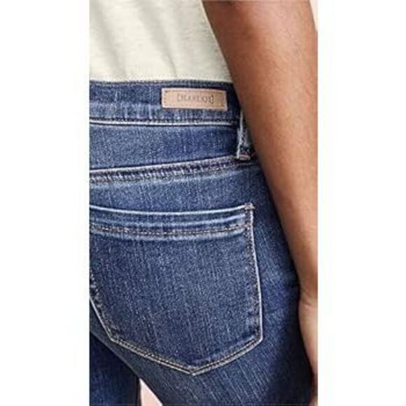 Blank NYC Bermuda Shorts Size 26 - Picture 5 of 10